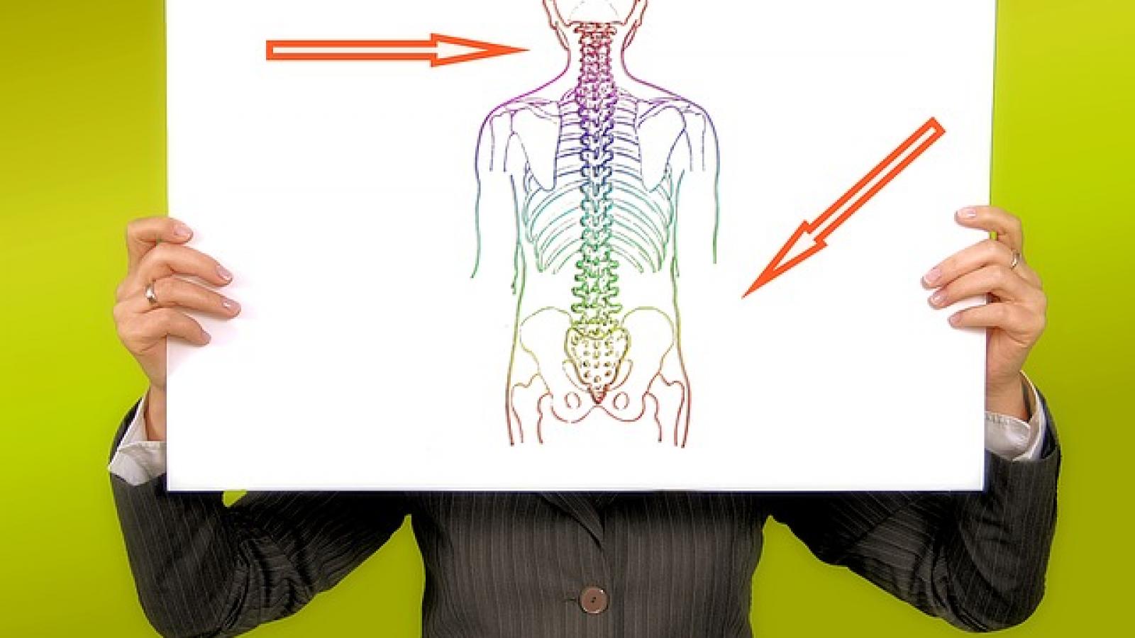 Academic holding up image of Musculoskeletal diagram with arrows