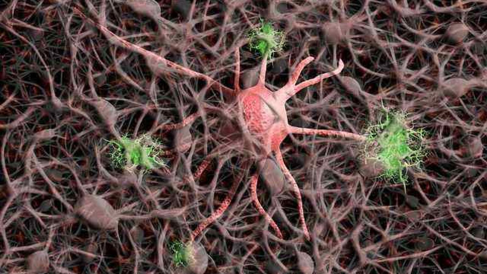 Neurons