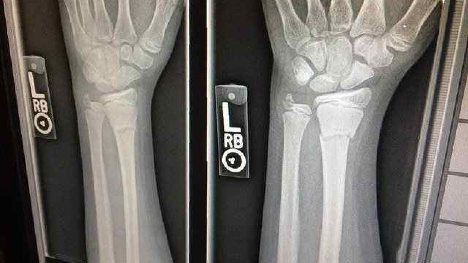 An X-ray