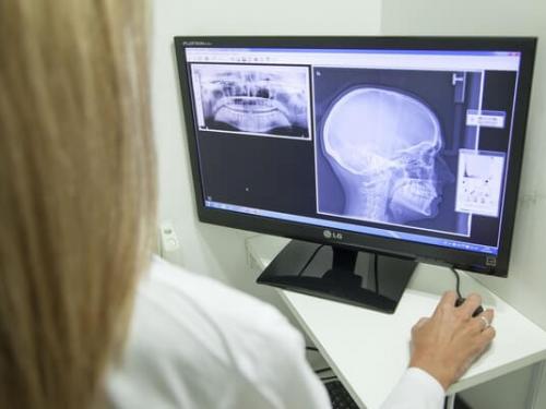 Access to Radiography